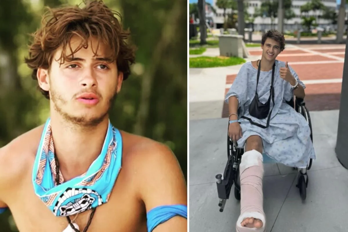 Survivor Stavros Floros son durumu: Bacağını kaybettikten sonra ilk paylaşım geldi