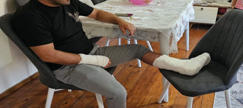 Kastamonu Cide'de Sokak Köpeği Saldırısı: Vatandaşın Ayağı Kırıldı